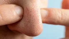 この問題に悩む人は多いが、解決がこんなに簡単だと知っている人は少ない。