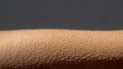 神経生物学的現象:なぜ肌に鳥肌が立つのか?